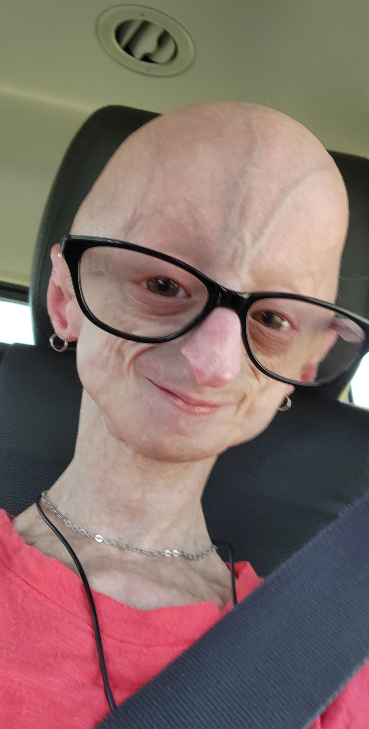 progeria lindsay