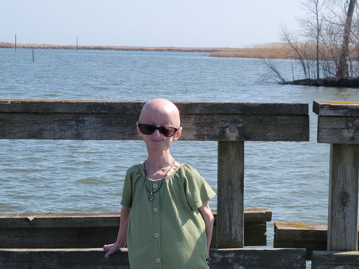 progeria lindsay